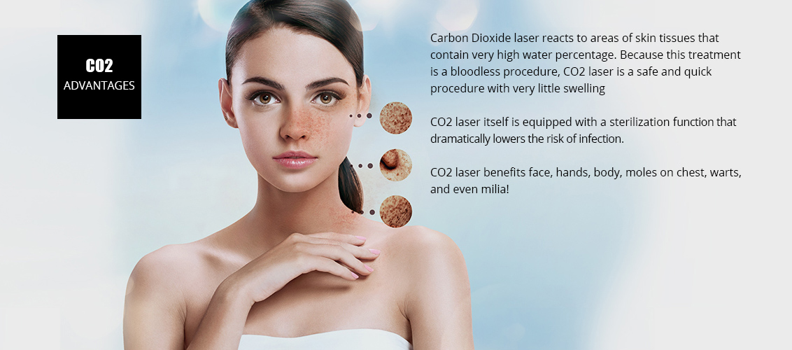 Carbon Dioxide laser reacts to areas of skin
				tissues that contain very high water percentage. 
				Because this treatment is a bloodless procedure, 
				CO2 laser is a safe and quick procedure with very 
				little swelling