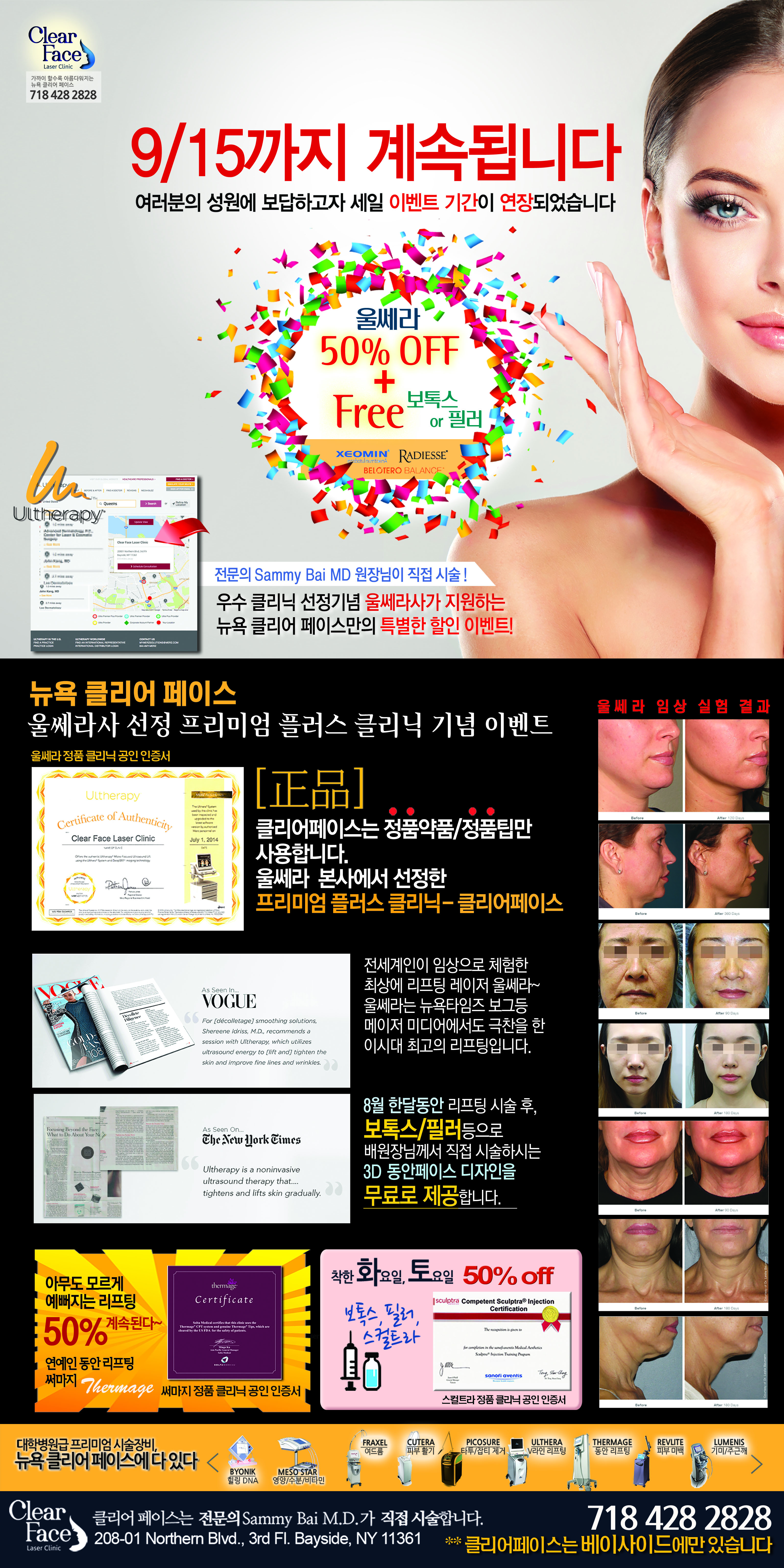 Ulthera AD(중앙전면)